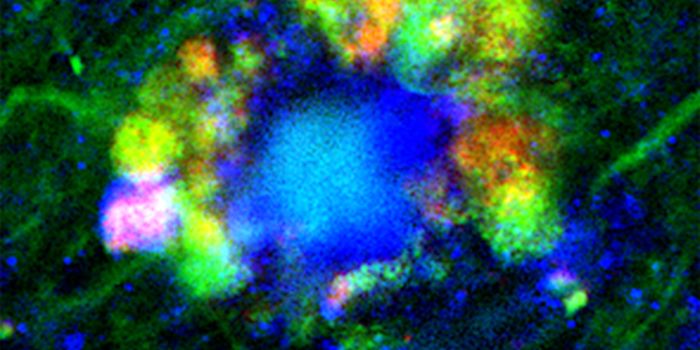 Fundamentally Changing Our Understanding of Alzheimer's Disease