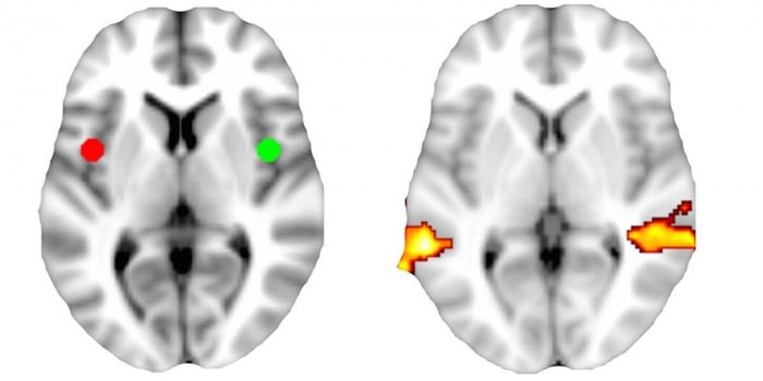 Depression Often Co-occurs with Joint Disease