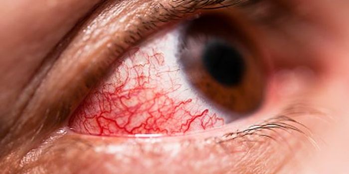 TSRI Scientists Find Potential Treatment for 'Painful Blindness' Form of Dry Eye