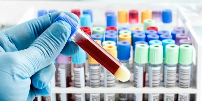 Cheap Blood Test May Reduce the Overuse of Antibiotics