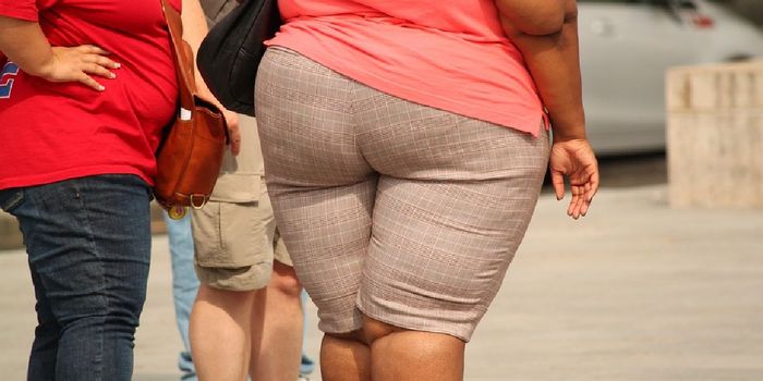 Midlife Obesity, not Diet, Increases Dementia Risk