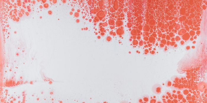 SGLT2 Inhibitors Can Reduce the Cardiovascular Risk for Diabetics Being Treated with Insulin