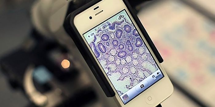 Using a Smartphone to Diagnose Parasitic Diseases