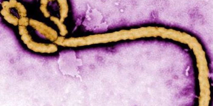 Increased Concern as Ebola Outbreak Spreads to a City