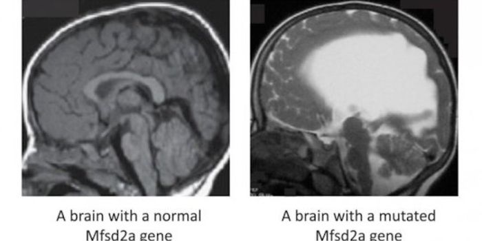 Really Good Fat: LPC Fat Critical to Brain Health
