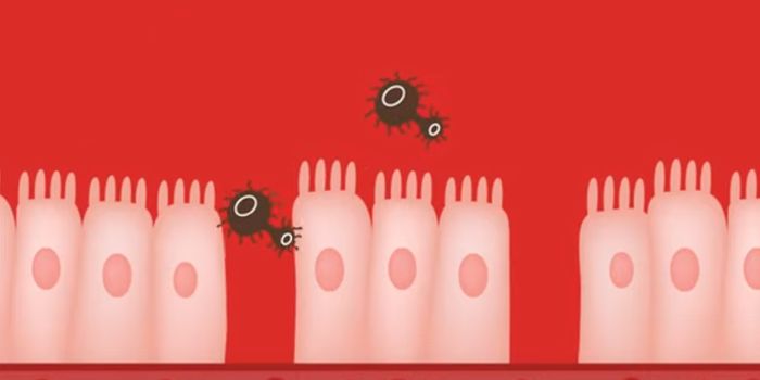 Noninvasive New Test Can Diagnose Bowel Disease