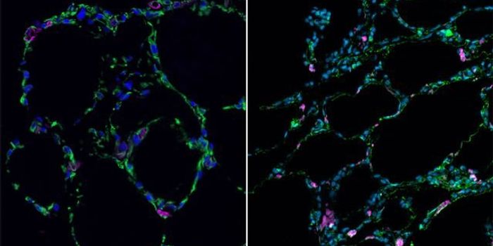 Scientists Grow 3-D Lung-in-a-Dish from Stem Cells
