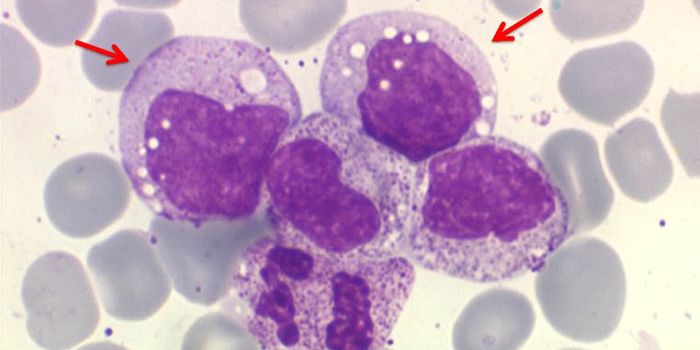 Scientists Create Polypeptide to Block Arterial Inflammation