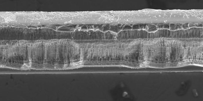 Fiber Optic Sensors for In-Body Bone Monitoring