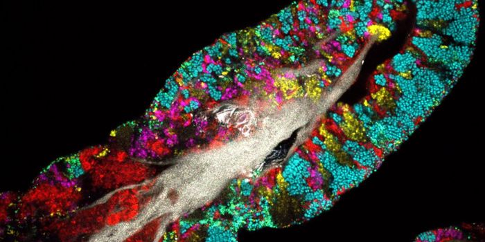 An Unknown Unknown - What's the State of Microbial Biodiversity?