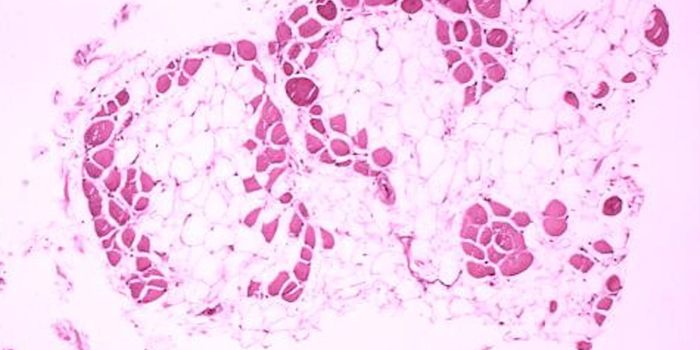 Making Bad Fat Turn Good