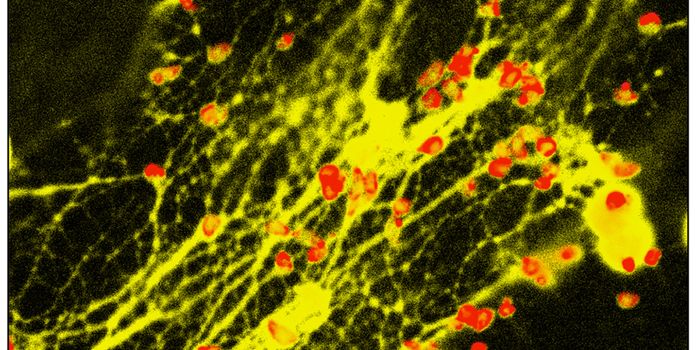 Immune cells trap bacteria with DNA, protein