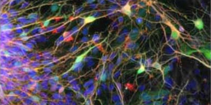 Studying the Evolution of the Human Brain