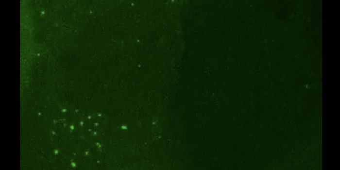 Monitoring a Virus in Real-Time as it Infects a Cell