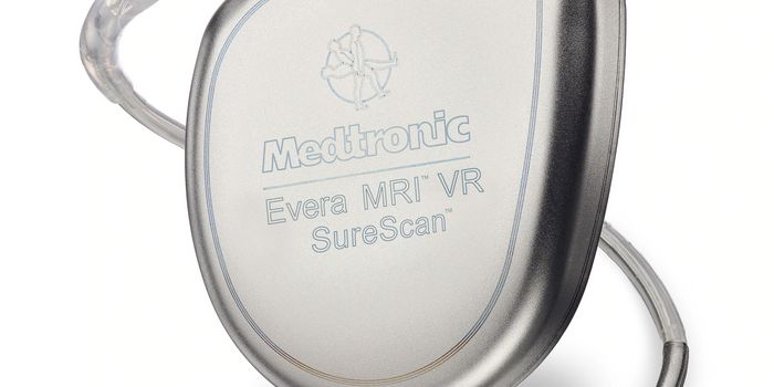 Electronic Fitness Gadgets Like Smartwatches Could Pose a Health Hazard