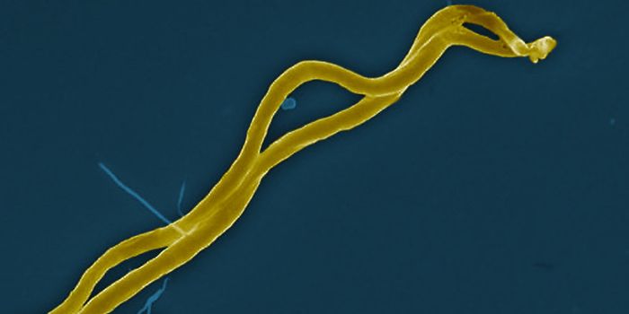 Improving the Diagnosis of a Tick-Borne Illness