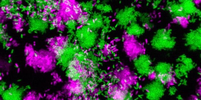 A Bacterial small RNA That Regulates Infection
