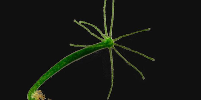 Did Sleep Precede the Brain?