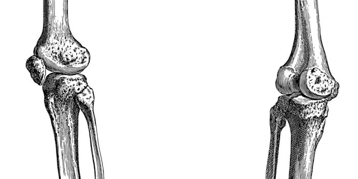 New Osteosarcoma Model for Drug Development