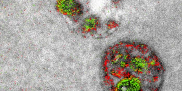 Electron Microscopy is now Multicolor!