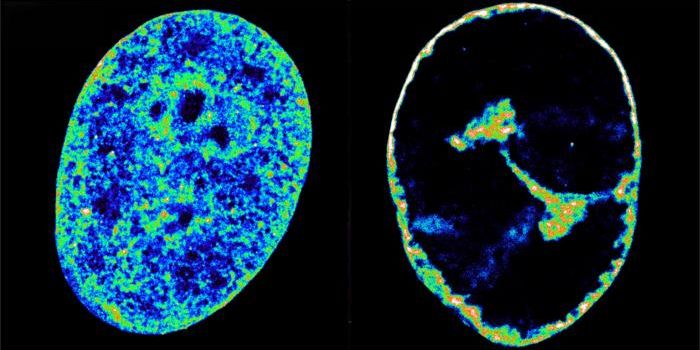 Herpes Can Reshape the Genome in Human Cells