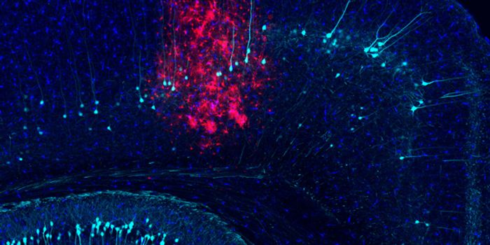 PLSCR1 Inhibition Tamps Down the Brain's Immune Response