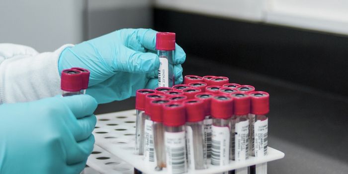 How Extracellular Vesicles Could be Used in Parkinson's Diagnosis