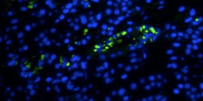 Detecting Dangerous Latent Viruses