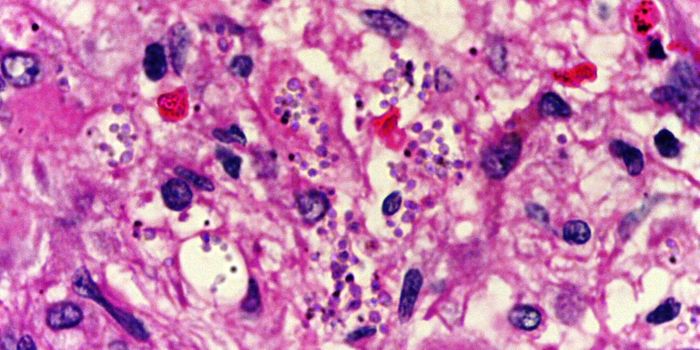 Chronic Infections Outsmart the Immune System