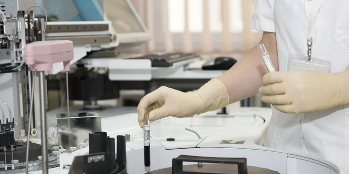 High Blood Pressure: The Prevalence of Aldosteronism