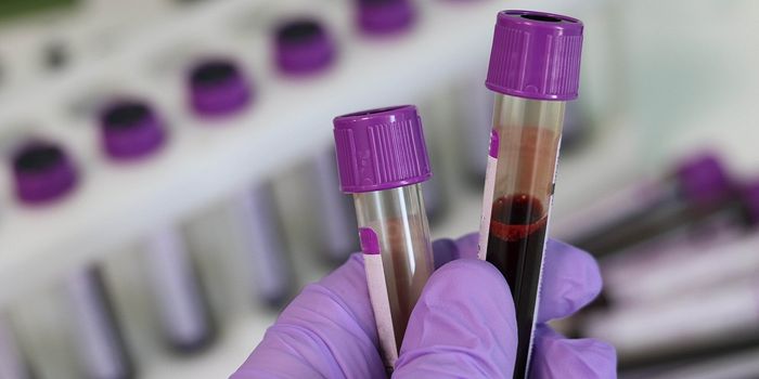 Kiss and tell: new test for kissing bug disease