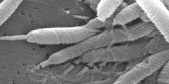 Ulcer-causing Microbe Found to Disrupt Mitochondria