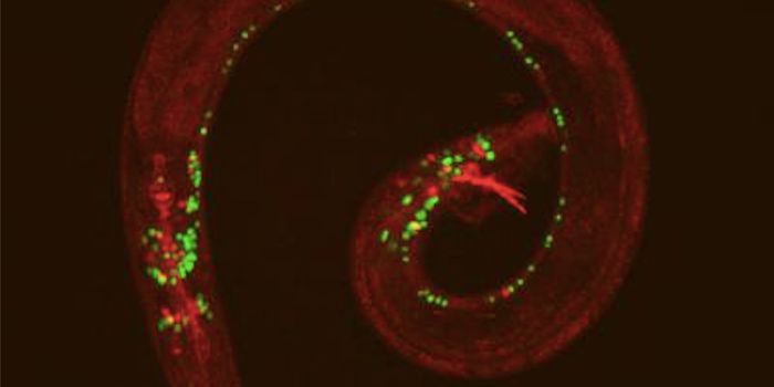 Insight Into the Molecular Basis of Differences in Male and Female Brains