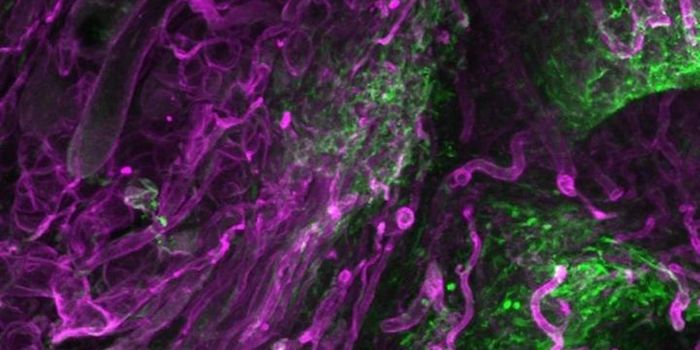 A New Understanding of How Scars Form