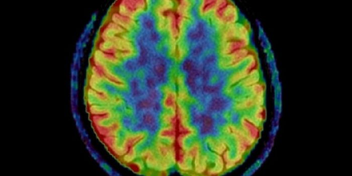 Using PET Technology and Protein Tracers to See CTE