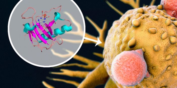 Drug Combination May Be Effective for Melanoma