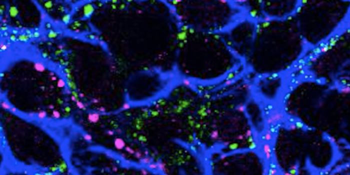 Learning how Irritable Bowel Syndrome Starts