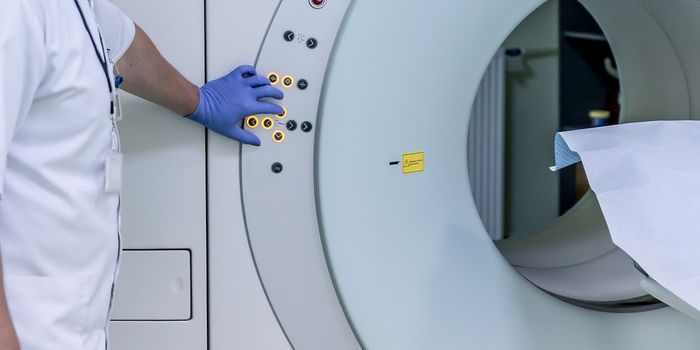 Whole body MRI shown to be most sensitive in detecting myeloma