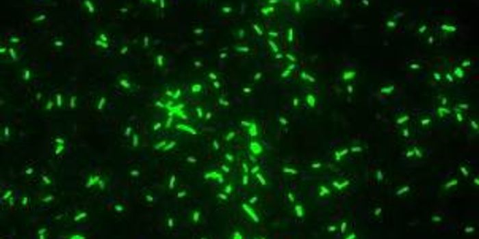 Rail Project Unearths Victims of the Black Death 