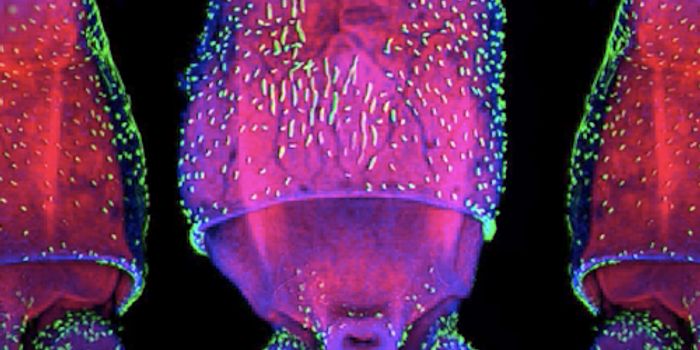 The Transition to Multicellular Life May Have Been Simple