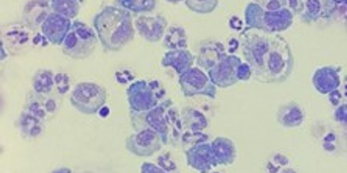 New Cell Population Found to Drive Cancer Progression