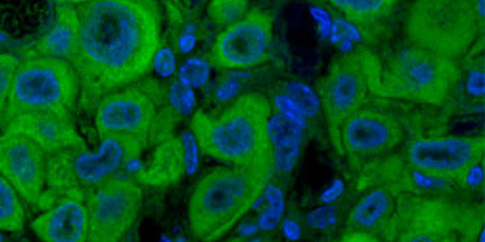 High Level of Vitamin C Kills Cancer, may Improve Therapeutics