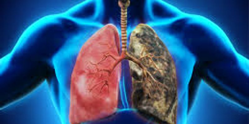 occupational-lung-disease-content-tag