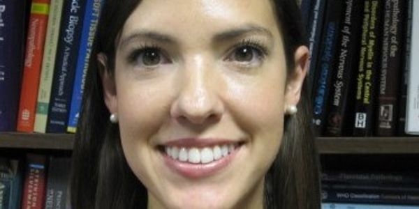 Subtyping Circulating Tumor Cells in Breast Cancer for Personalized Therapeutics