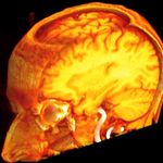 Rational Thoughts in Neural Codes