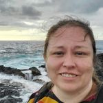 Higher Resolution Electrodes Improve Our Understanding Human Brain, Cognition, and Neurological Pathologies