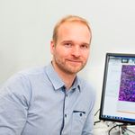 Deciphering the spreading of neuropathologies in neuronal circuits using a high capacity microfluidics platform