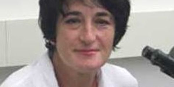 ABCA1 and APOE: Intertwined roles in Alzheimers disease